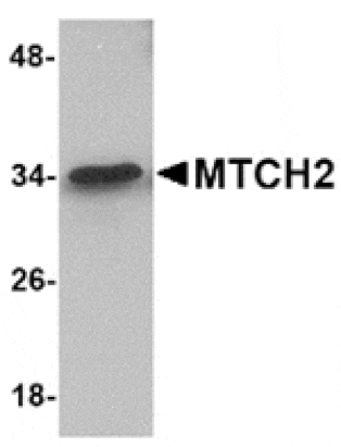 Western blot - MTCH2 Antibody from Signalway Antibody (24850) - Antibodies.com