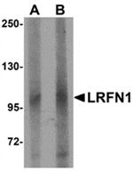 Western blot analysis of LRFN1 in human brain lysate with LRFN1 antibody at (A) 1 and (B) 2 µg/mL.