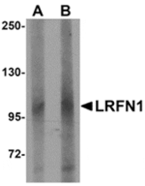 Western blot - LRFN1 Antibody from Signalway Antibody (24851) - Antibodies.com