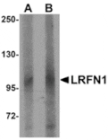 Western blot - LRFN1 Antibody from Signalway Antibody (24851) - Antibodies.com