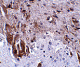 Immunohistochemistry - LRFN1 Antibody from Signalway Antibody (24851) - Antibodies.com