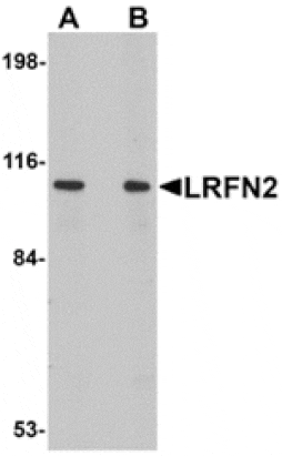 Western blot - LRFN2 Antibody from Signalway Antibody (24852) - Antibodies.com