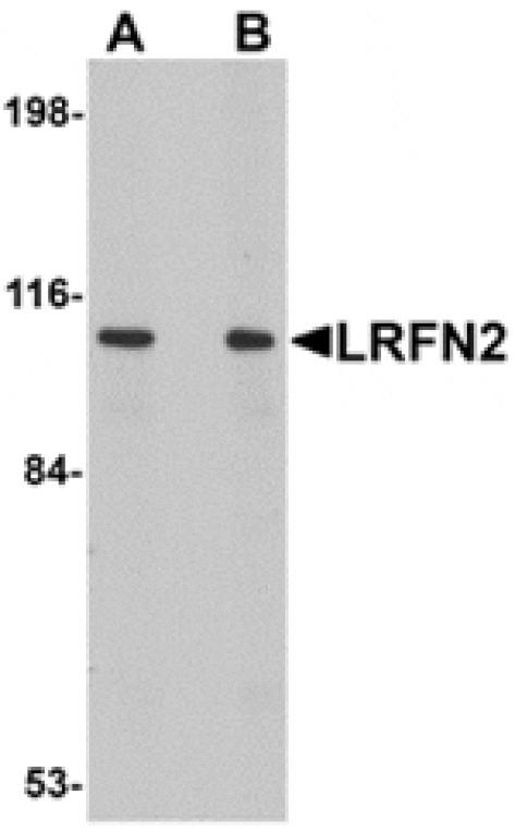 Western blot - LRFN2 Antibody from Signalway Antibody (24852) - Antibodies.com