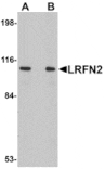 Western blot - LRFN2 Antibody from Signalway Antibody (24852) - Antibodies.com