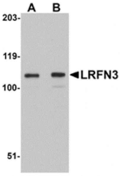 Western blot - LRFN3 Antibody from Signalway Antibody (24853) - Antibodies.com