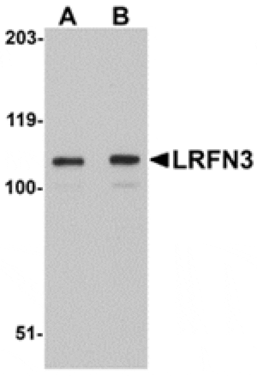 Western blot - LRFN3 Antibody from Signalway Antibody (24853) - Antibodies.com