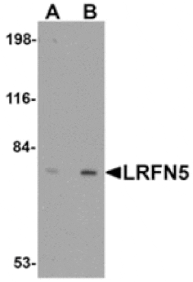 Western blot - LRFN5 Antibody from Signalway Antibody (24858) - Antibodies.com