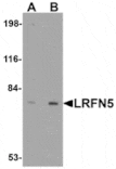 Western blot - LRFN5 Antibody from Signalway Antibody (24858) - Antibodies.com