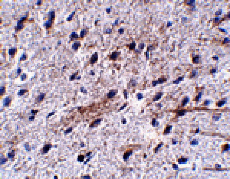 Immunohistochemistry - LRFN5 Antibody from Signalway Antibody (24858) - Antibodies.com