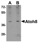 Western blot analysis of ATOH8 in A-20 cell lysate with ATOH8 antibody at (A) 1 and (B) 2 µg/mL.