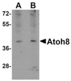 Western blot - ATOH8 Antibody from Signalway Antibody (24867) - Antibodies.com