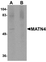 Western blot analysis of MATN4 in rat brain tissue lysate with MATN4 antibody at 1 µg/mL in (A) the absence and (B) the presence of blocking peptide.