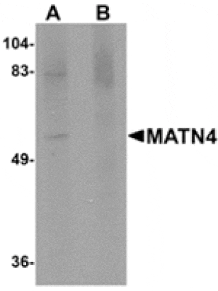 Western blot - MATN4 Antibody from Signalway Antibody (24870) - Antibodies.com