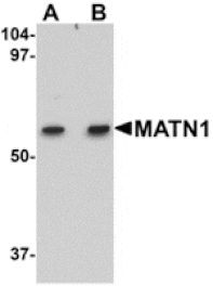 Western blot - MATN1 Antibody from Signalway Antibody (24875) - Antibodies.com