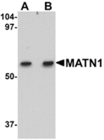 Western blot - MATN1 Antibody from Signalway Antibody (24875) - Antibodies.com