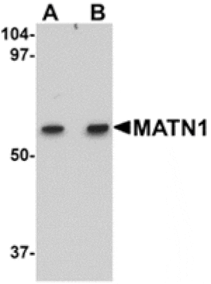 Western blot - MATN1 Antibody from Signalway Antibody (24875) - Antibodies.com
