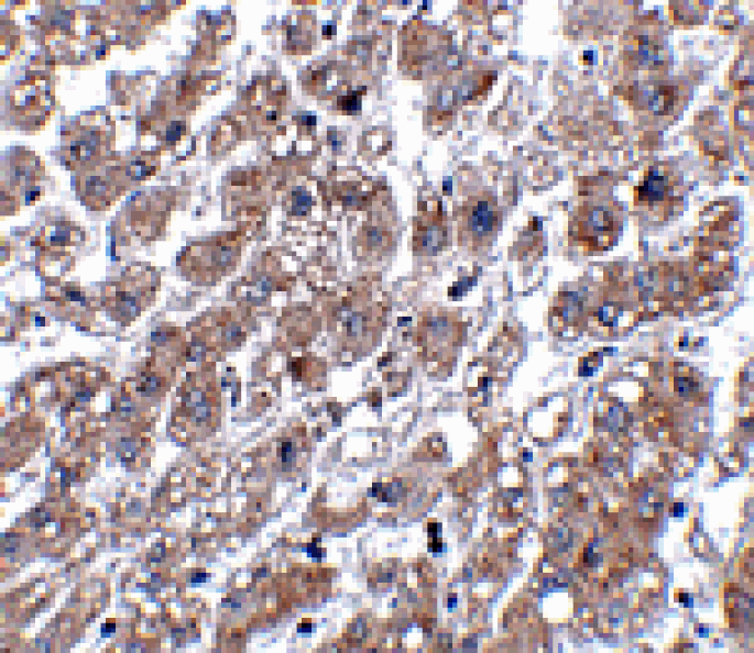 Immunohistochemistry - MATN1 Antibody from Signalway Antibody (24875) - Antibodies.com