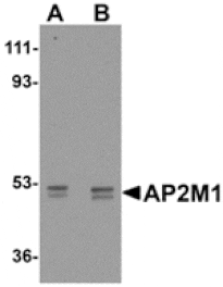 Western blot - AP2M1 Antibody from Signalway Antibody (24892) - Antibodies.com