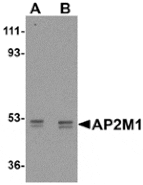 Western blot - AP2M1 Antibody from Signalway Antibody (24892) - Antibodies.com