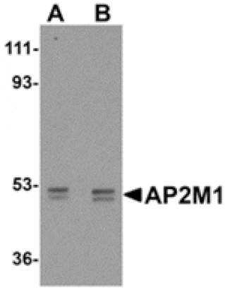 Western blot - AP2M1 Antibody from Signalway Antibody (24892) - Antibodies.com