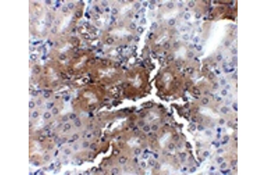 Immunohistochemistry - AP2M1 Antibody from Signalway Antibody (24892) - Antibodies.com
