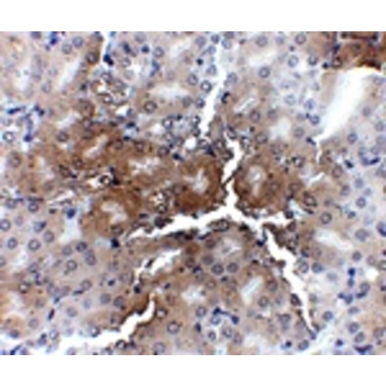 Immunohistochemistry - AP2M1 Antibody from Signalway Antibody (24892) - Antibodies.com