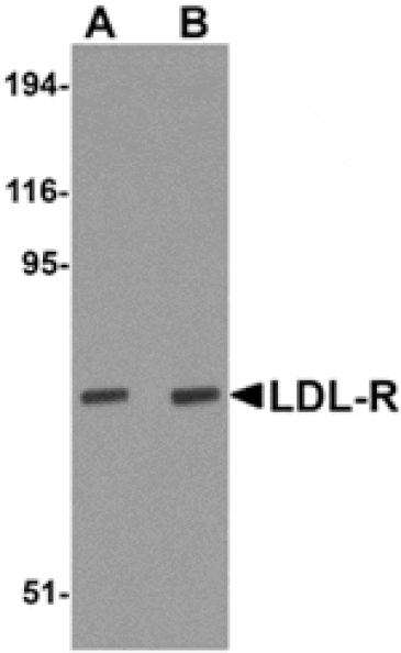 Western blot - LDL-R Antibody from Signalway Antibody (24893) - Antibodies.com