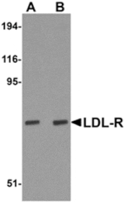 Western blot - LDL-R Antibody from Signalway Antibody (24893) - Antibodies.com