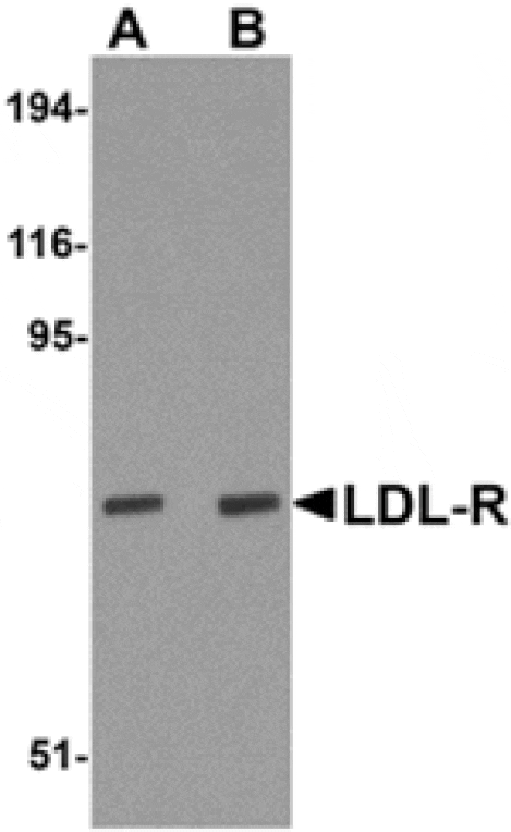 Western blot - LDL-R Antibody from Signalway Antibody (24893) - Antibodies.com