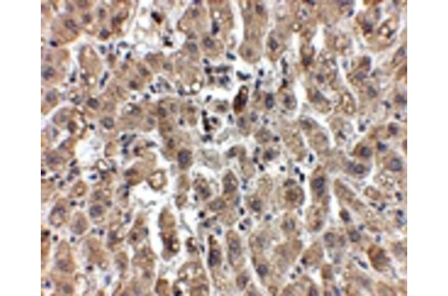 Immunohistochemistry - LDL-R Antibody from Signalway Antibody (24893) - Antibodies.com