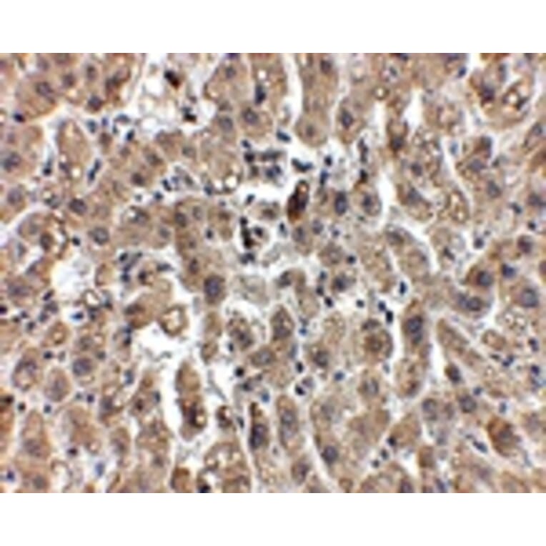 Immunohistochemistry - LDL-R Antibody from Signalway Antibody (24893) - Antibodies.com