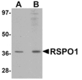 Western blot - RSPO1 Antibody from Signalway Antibody (24897) - Antibodies.com