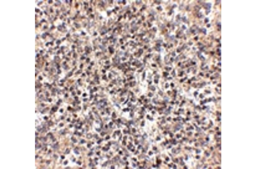 Immunohistochemistry - RSPO1 Antibody from Signalway Antibody (24897) - Antibodies.com