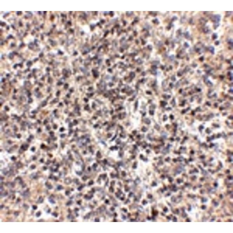 Immunohistochemistry - RSPO1 Antibody from Signalway Antibody (24897) - Antibodies.com