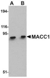 Western blot - MACC1 Antibody from Signalway Antibody (24905) - Antibodies.com