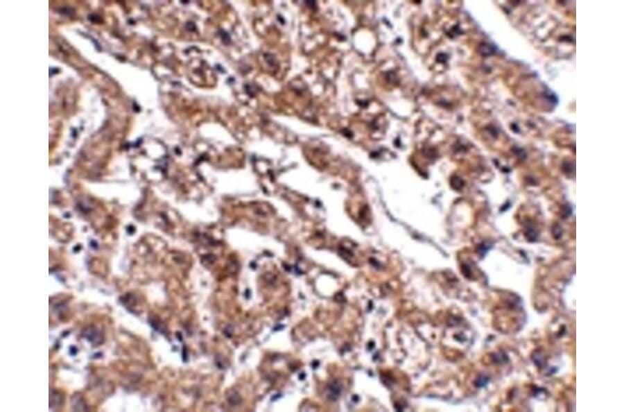 Immunohistochemistry - MACC1 Antibody from Signalway Antibody (24905) - Antibodies.com