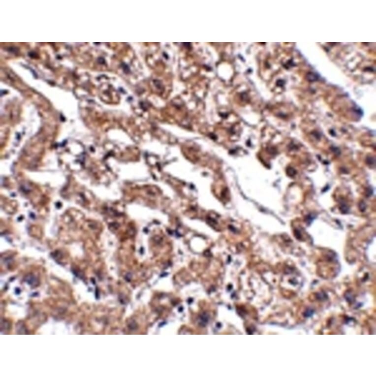 Immunohistochemistry - MACC1 Antibody from Signalway Antibody (24905) - Antibodies.com