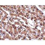 Immunohistochemistry - MACC1 Antibody from Signalway Antibody (24905) - Antibodies.com