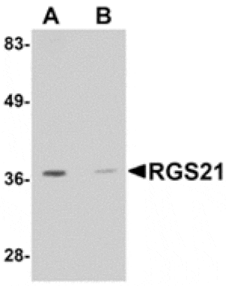 Western blot - RGS21 Antibody from Signalway Antibody (24907) - Antibodies.com