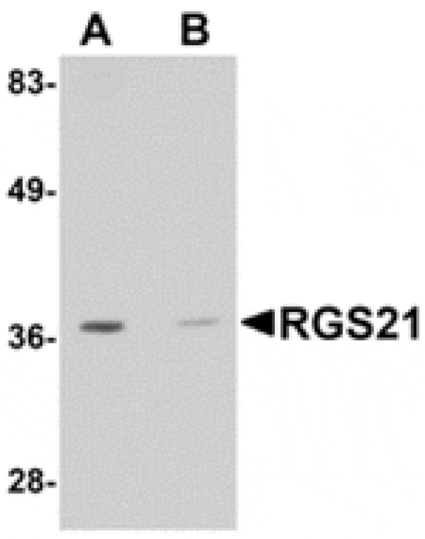 Western blot - RGS21 Antibody from Signalway Antibody (24907) - Antibodies.com