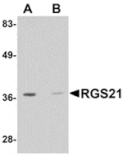 Western blot - RGS21 Antibody from Signalway Antibody (24907) - Antibodies.com