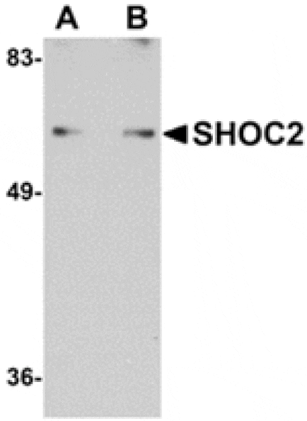 Western blot - SHOC2 Antibody from Signalway Antibody (24910) - Antibodies.com