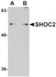 Western blot - SHOC2 Antibody from Signalway Antibody (24910) - Antibodies.com