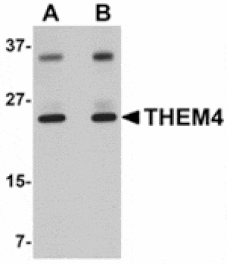 Western blot - THEM4 Antibody from Signalway Antibody (24916) - Antibodies.com