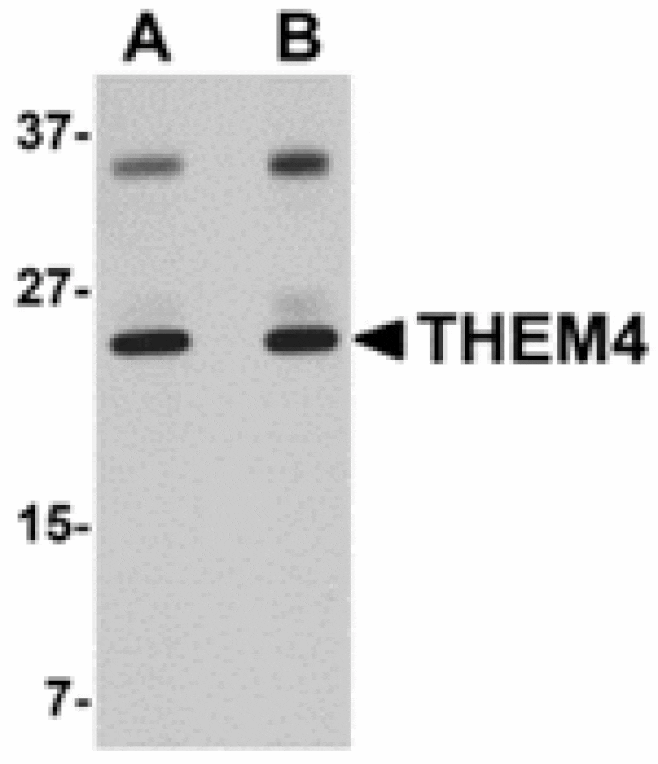 Western blot - THEM4 Antibody from Signalway Antibody (24916) - Antibodies.com