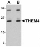 Western blot - THEM4 Antibody from Signalway Antibody (24916) - Antibodies.com