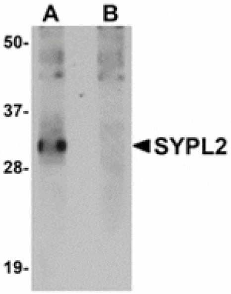 Western blot - SYPL2 Antibody from Signalway Antibody (24928) - Antibodies.com