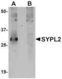 Western blot - SYPL2 Antibody from Signalway Antibody (24928) - Antibodies.com