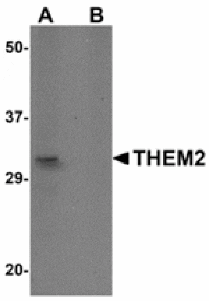 Western blot - THEM2 Antibody from Signalway Antibody (24929) - Antibodies.com