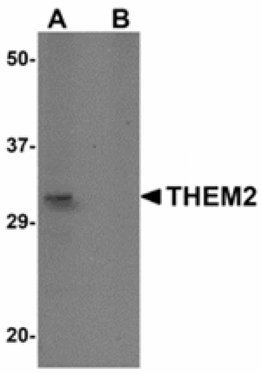 Western blot - THEM2 Antibody from Signalway Antibody (24929) - Antibodies.com